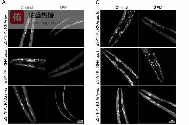 聚胺原理如何为阿尔茨海默病带来新希望？