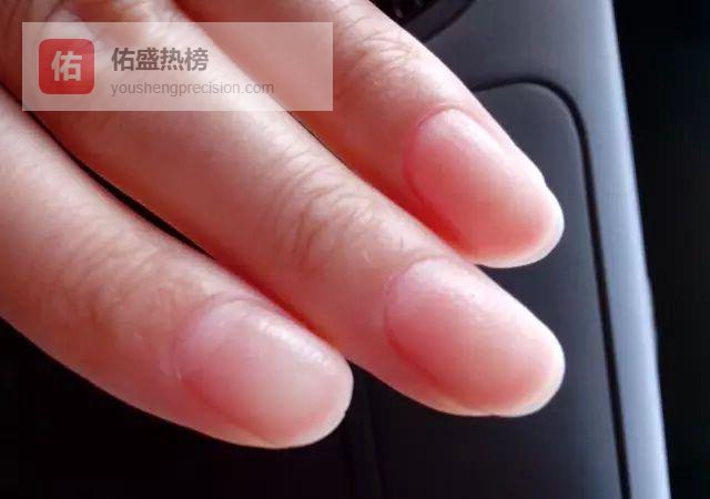 指甲里的健康暗语：一眼看懂身体报警信号