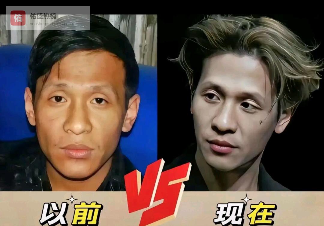 600刀植眉上热搜，宋小宝把医美坦白局说成脱口秀