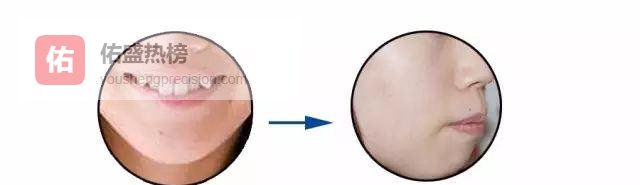 虎牙：可爱还是隐患？一张图看懂利弊与对策