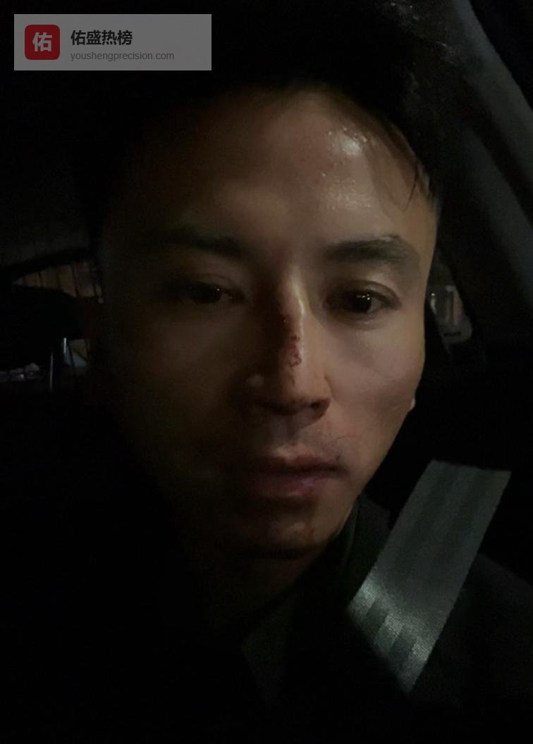 华人男生奥克兰街头直播遭十人围打鼻子骨折签证剩十天求说法