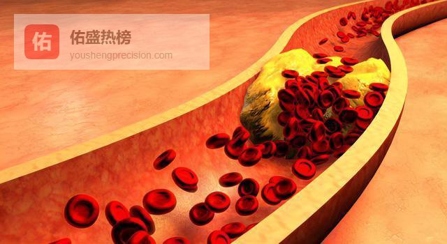 睡前四个习惯悄悄堵塞脑血管，现在知道还不晚！