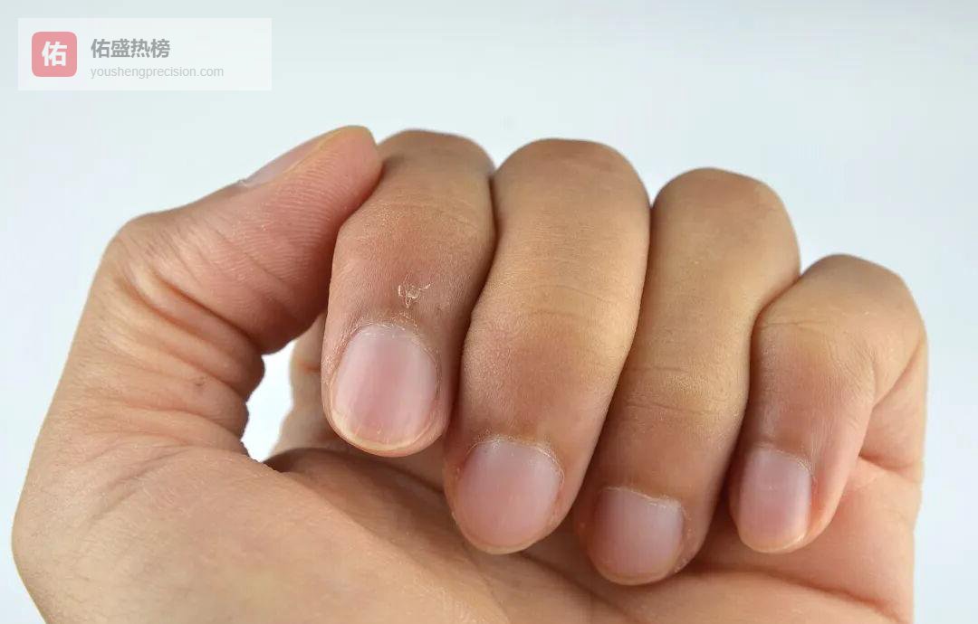 别再随手撕倒刺！一张图看懂正确处理步骤