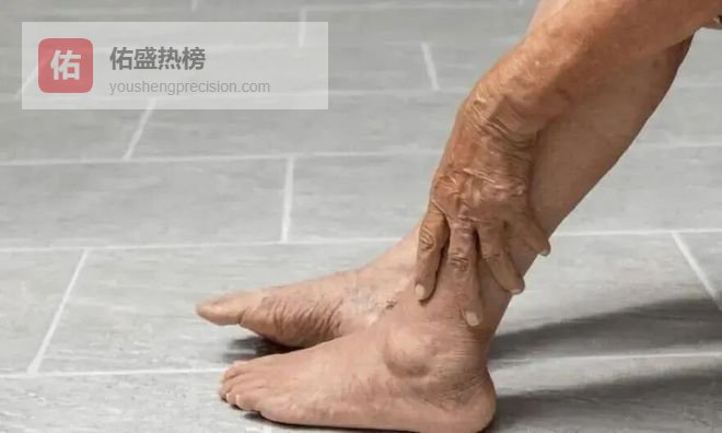 救命！帕金森患者春分养脑，常吃3种红色“多巴胺”食物，告别僵硬、健步如飞！