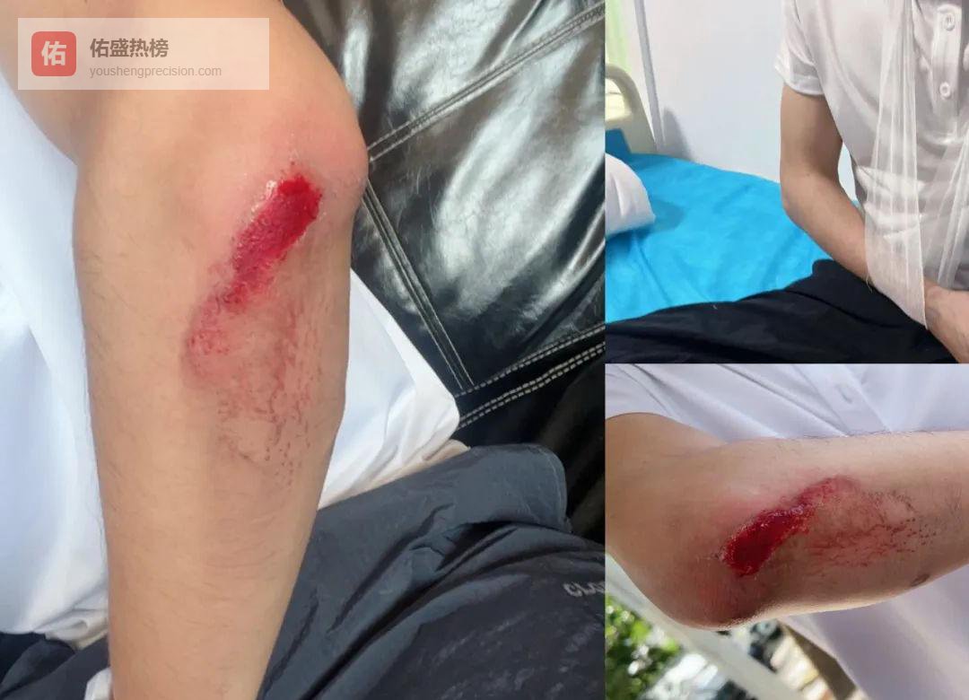 柬埔寨飞车党：光天化日下的“秒抢”陷阱