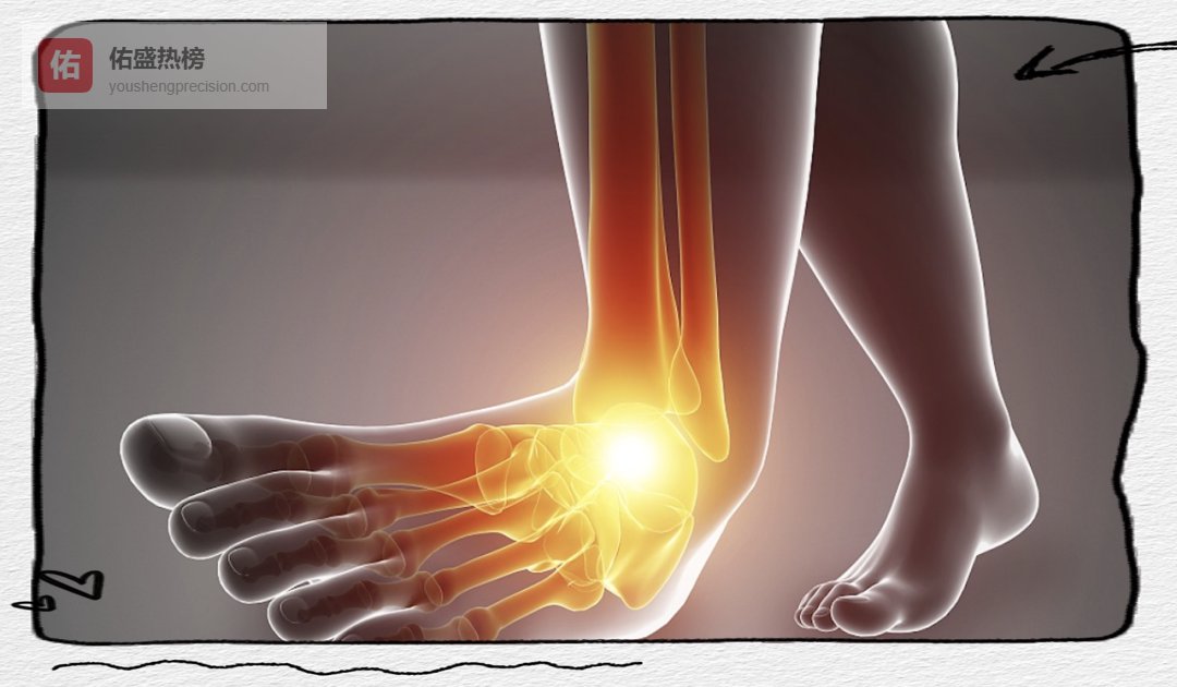 30秒自测崴脚风险：别让一次小扭伤毁掉一辈子